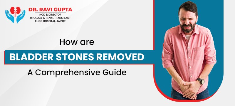 How are Bladder Stones Removed: A Comprehensive Guide