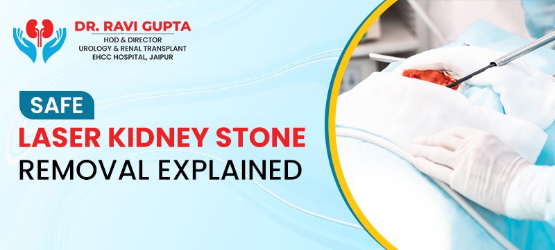 Safe Laser Kidney Stone Removal Explained