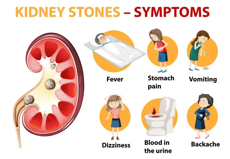 10 Side Effects of Kidney Disease