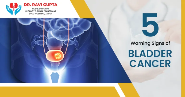 What are the 5 Warning Signs of Bladder Cancer?