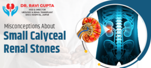 Misconceptions About Small Calyceal Renal Stones