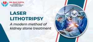 Laser Lithotripsy a modern method