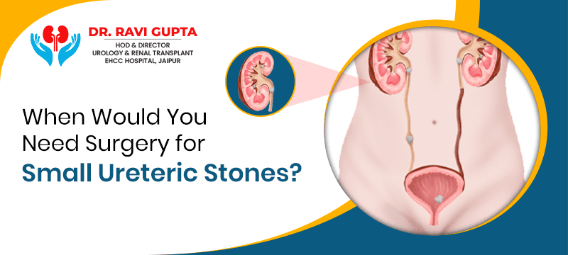 When a Person Needs Surgery for Small Ureteric Stones?