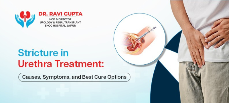 Stricture in Urethra Treatment: Causes, Symptoms, and Best Cure Options