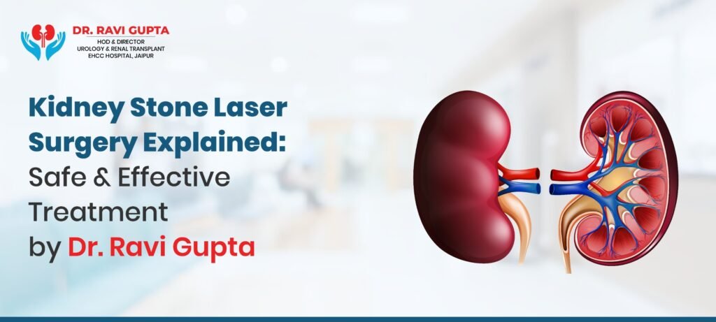 Kidney Stone Laser Surgery Explained: Safe & Effective Treatment by Dr. Ravi Gupta