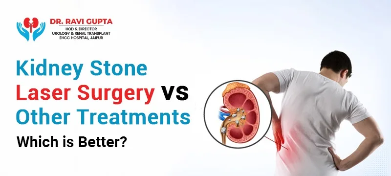 Kidney Stone Laser Surgery vs Other Treatments: Which is Better?